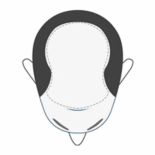 Full top of head
