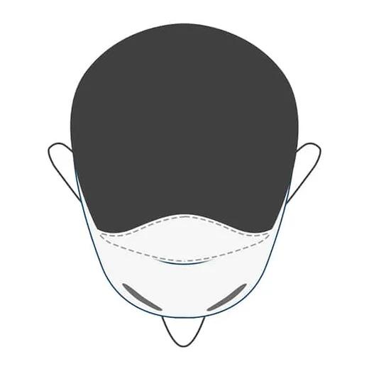 Receding hairline