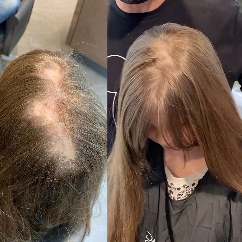 Topper before After Image