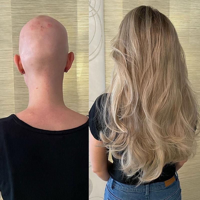 Hair System Before After Image