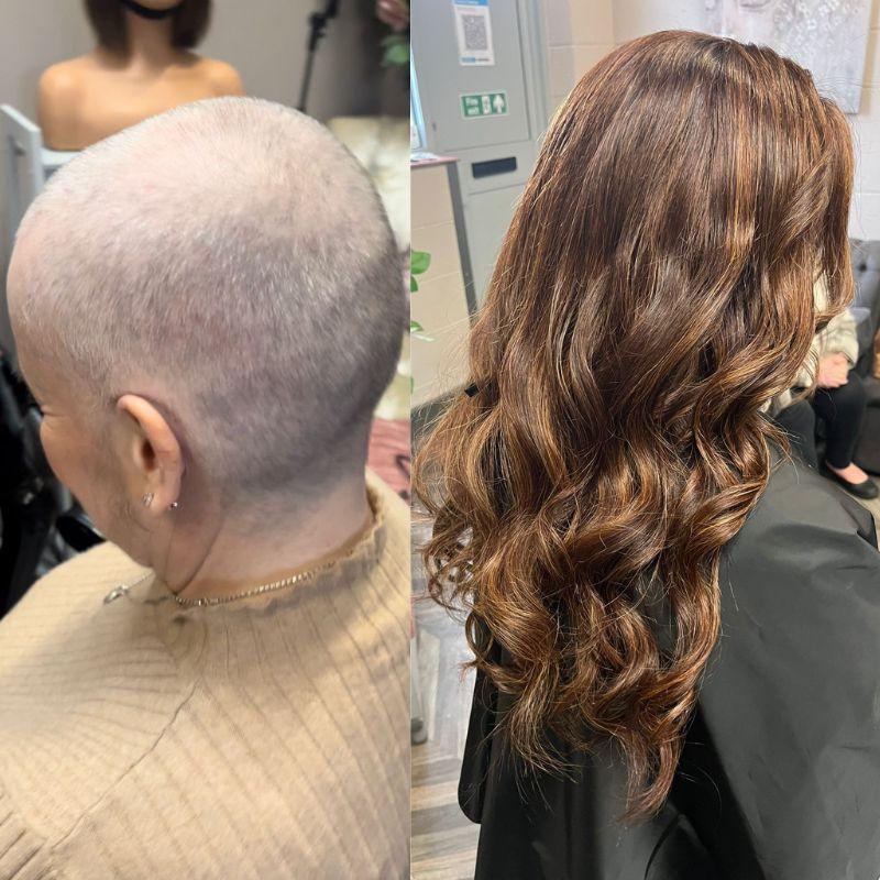 Hair System Before After Image
