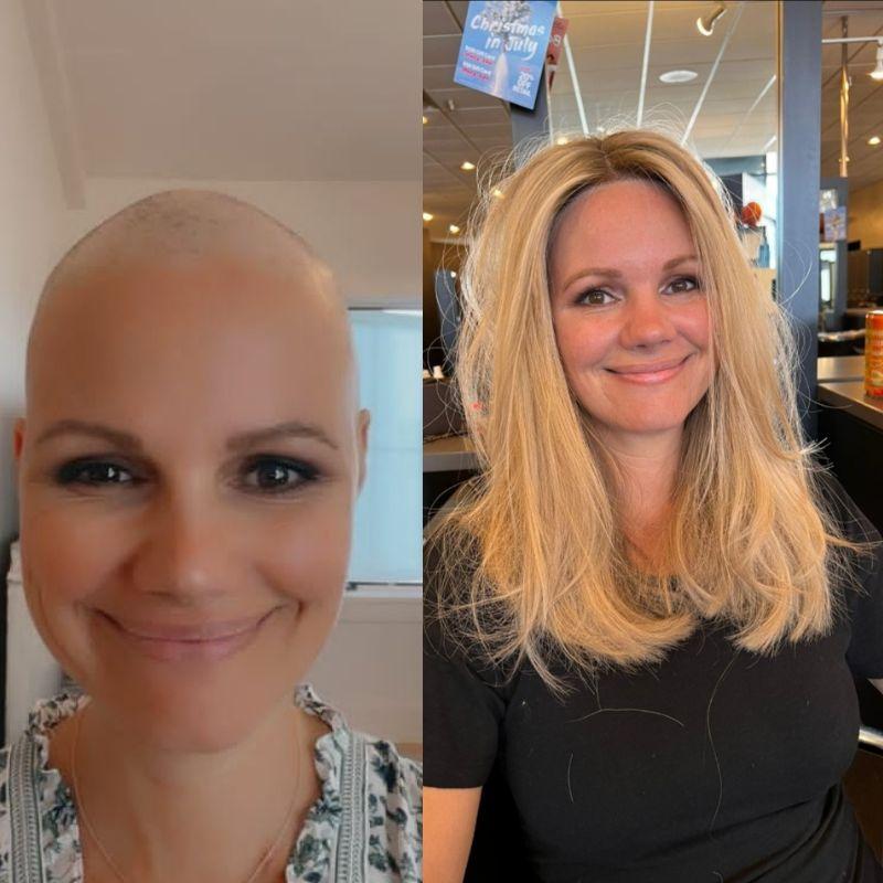 Hair System Before After Image