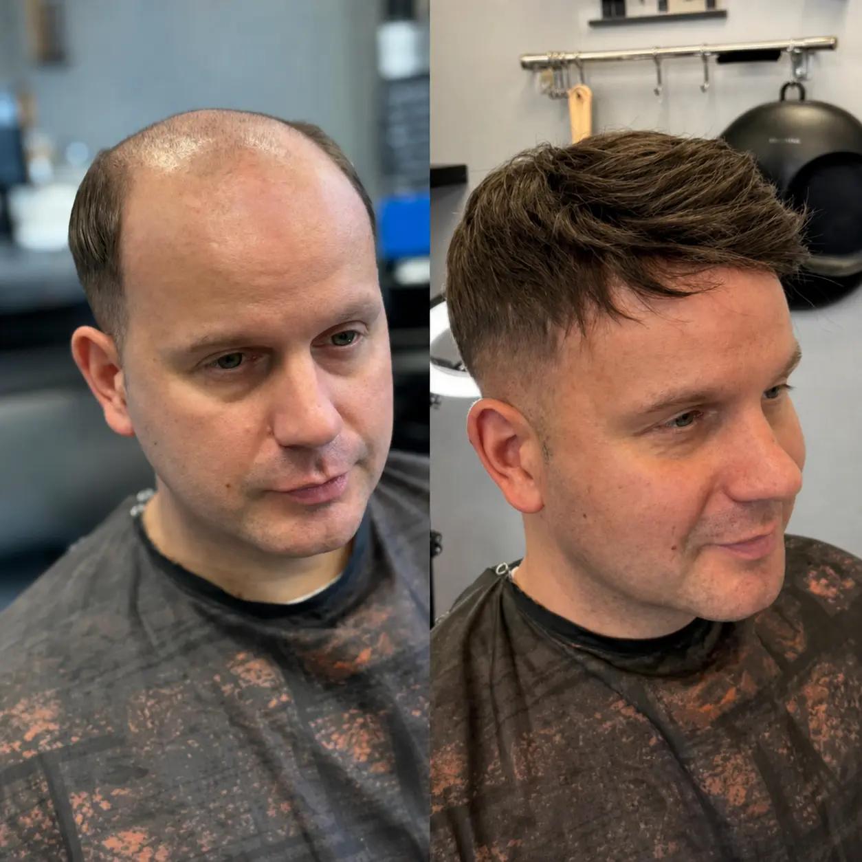 Hair System Before After Image