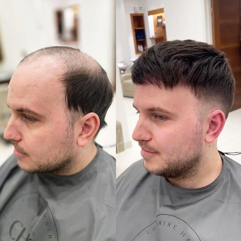 Hair System Before After Image