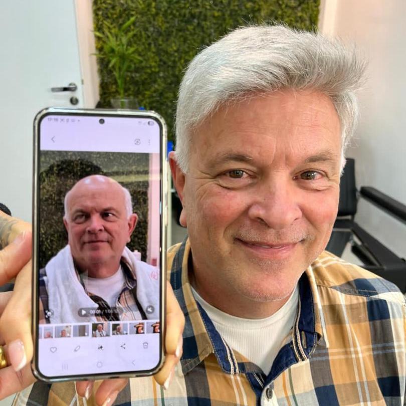 Hair System Before After Image