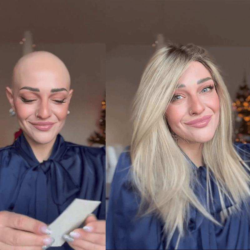 Hair System Before After Image