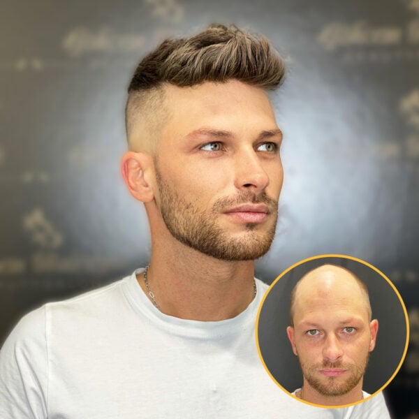 HS7 Full French Lace Hair System for Men (3)