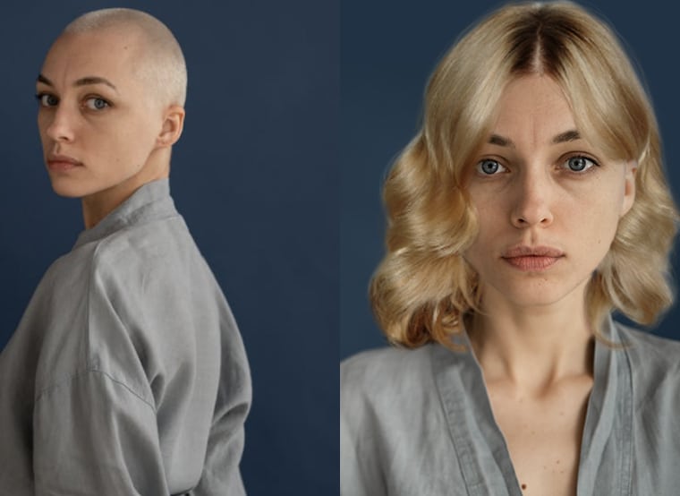 female-alopecia-solution-1
