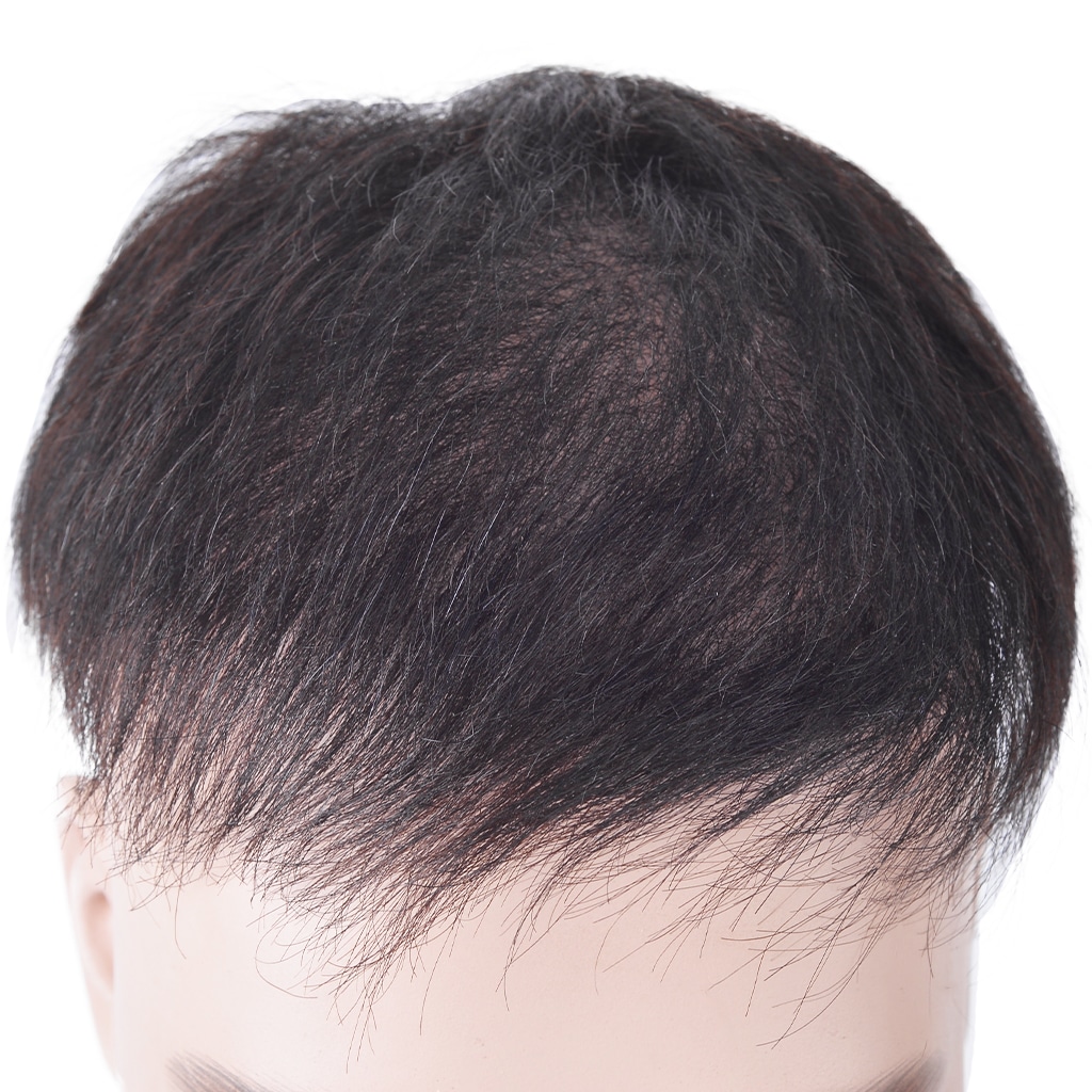 Fine-Welded-Mono-Hair-System-with-Light-Density-4