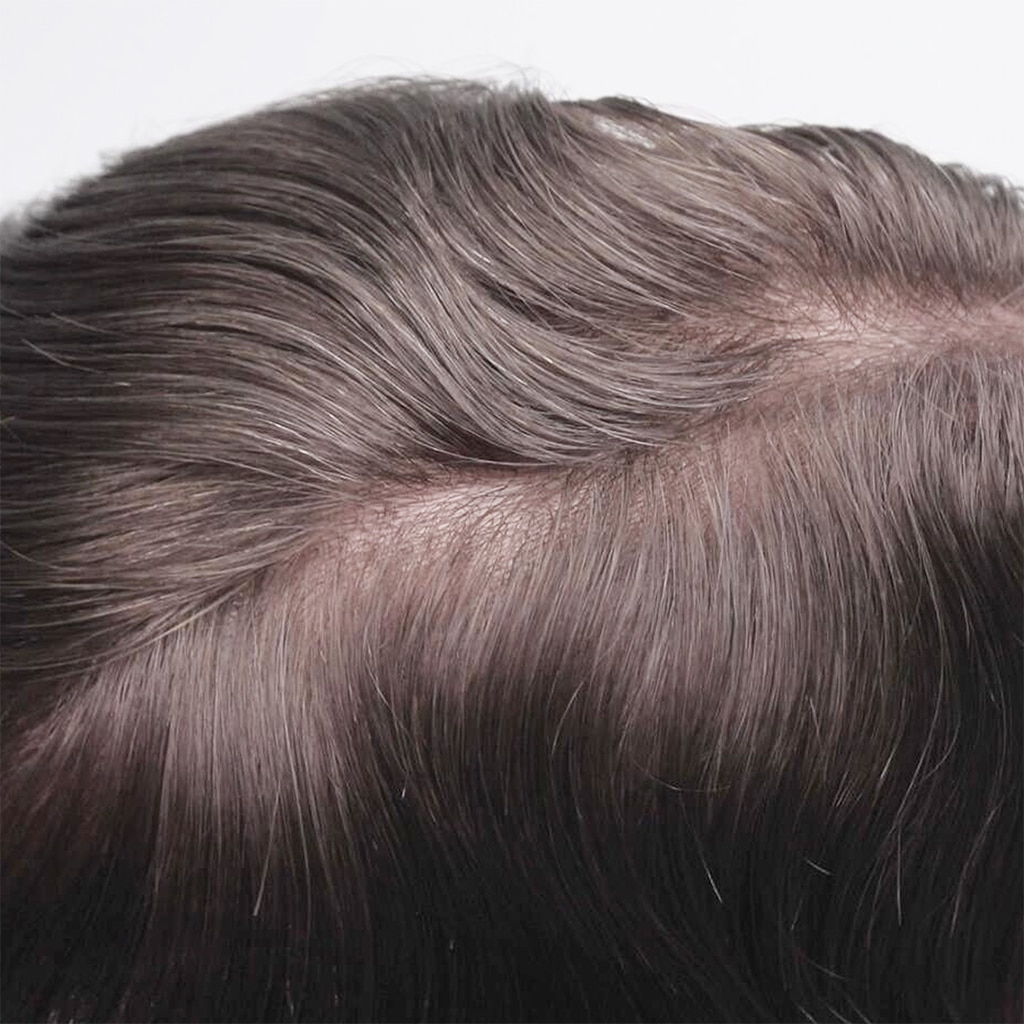 HS25V-0.03mm-Ultra-Thin-Skin-Hair-System-with-V-Loops-All-Over-3
