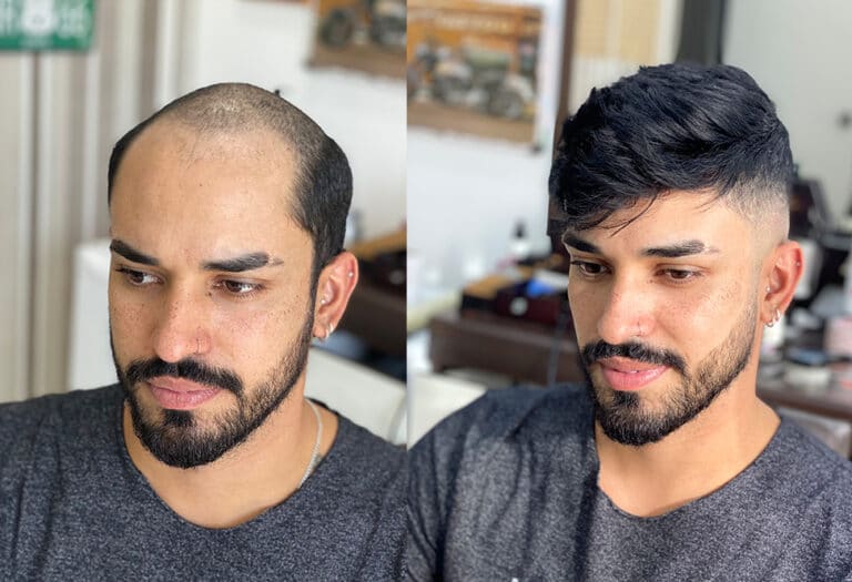 MEN-Before-after3@2x-1