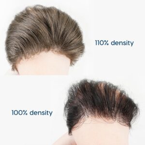 Mens-Frontal-Hair-Piece-06mm-Knotless-Skin-19