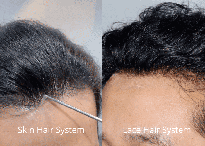 lace-vs.-poly-hair-system-hairline