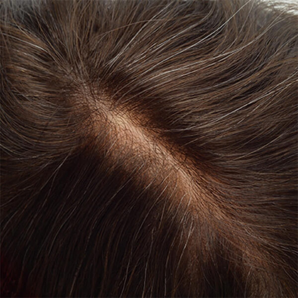 nl1360-super-thin-skin-V-looped-mens-toupee-3
