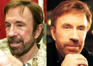 Male Celebrities Who Wear Toupees and Wigs Due to Hair Loss