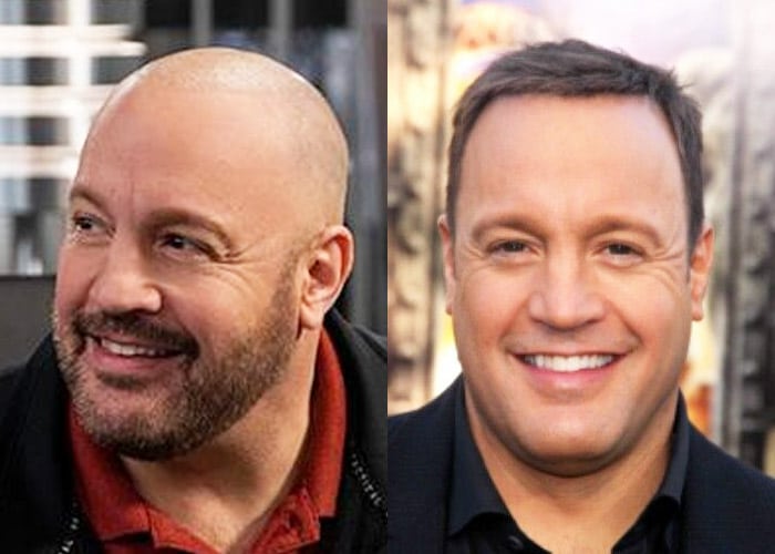Male Celebrities Who Wear Toupees and Wigs Due to Hair Loss