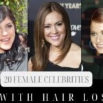 20 Female Celebrities Opened Up About Their Hair Loss Experience