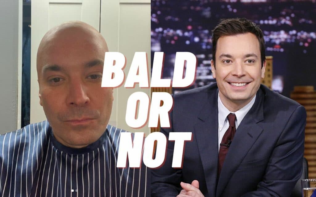 is-jimmy-fallon-bald-or-not