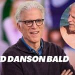 Is-Ted-danson-bald