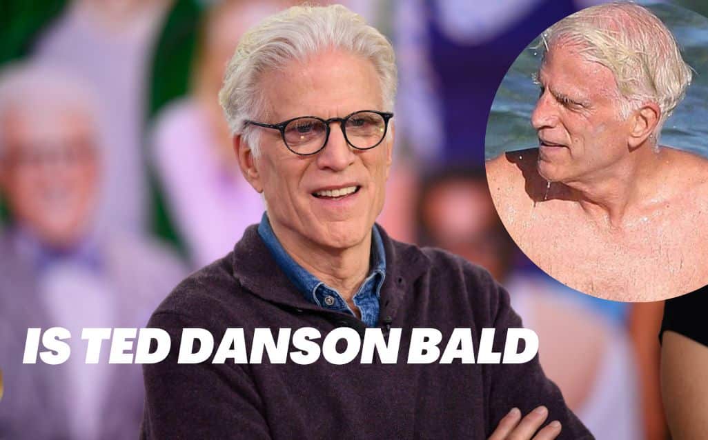 Is-Ted-danson-bald