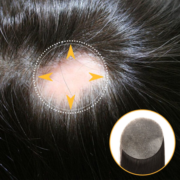 WPT-Womens-Skin-Base-Hair-Patches-for-Alopecia-Areata-1