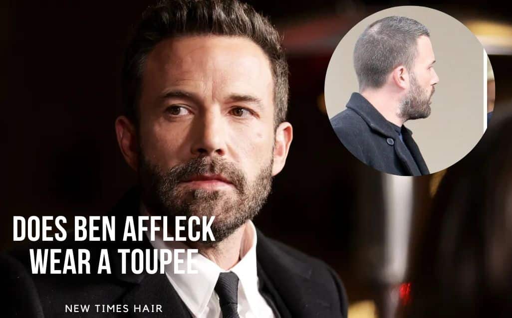 does-ben-affleck-wear-a-toupee