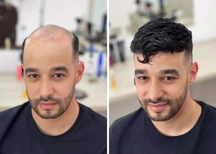 toupee-hairstyle-beforeafter-2