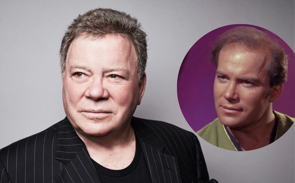 does-william-shatner-wear-a-toupee