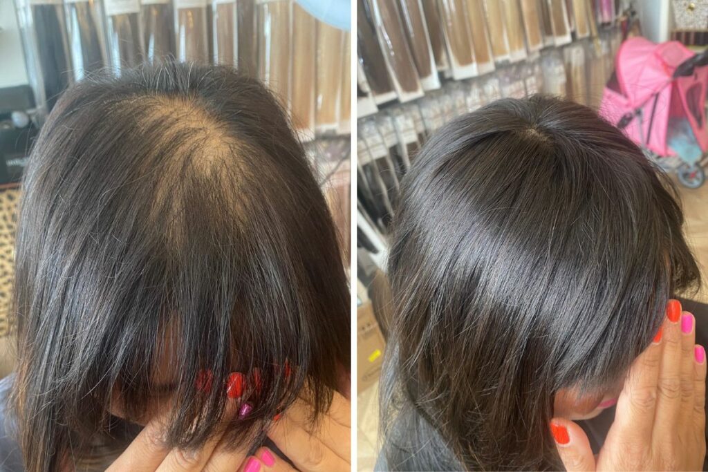 Best Hair Extensions For Balding Crowns And How To Attach Best Hair Extensions For Balding Crowns And How To Attach
