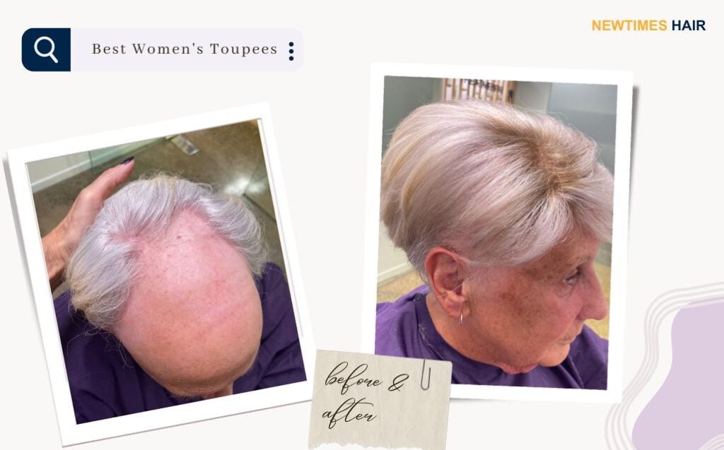 Before and after an elderly lady had one of the best hair systems for women (women's hair piece) installed to her head and the hair styled