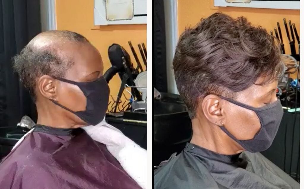 Before and after one of our Afro clients had one of our hair systems for women installed in a salon