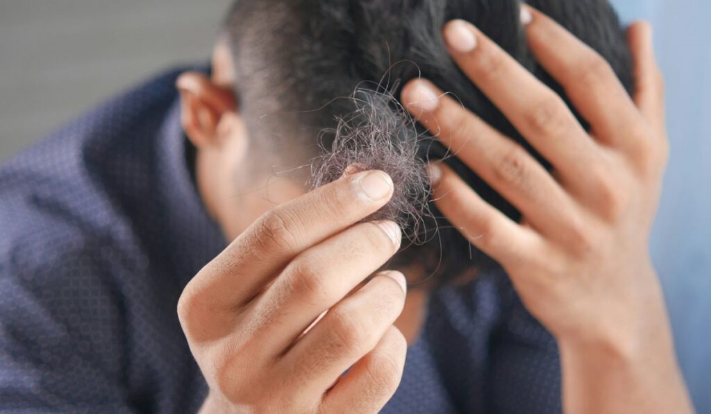A guy pulling his hair off as suffering from hair loss